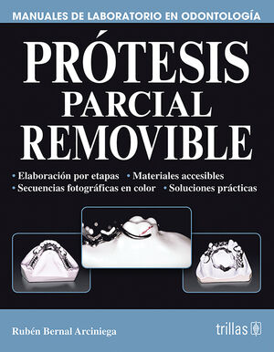 PROTESIS PARCIAL REMOVIBLE