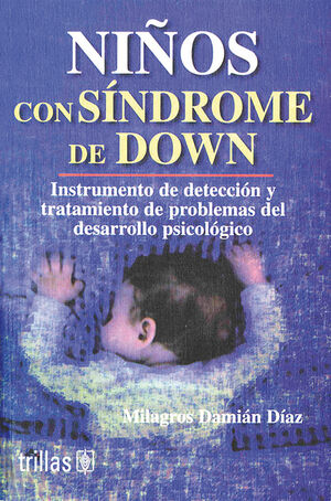 NIÑOS CON SINDROME DE DOWN