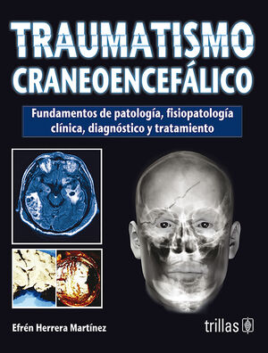TRAUMATISMO CRANEOENCEFALICO