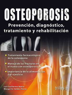 Osteoporosis