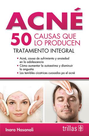 ACNE: 50 CAUSAS QUE LO PRODUCEN