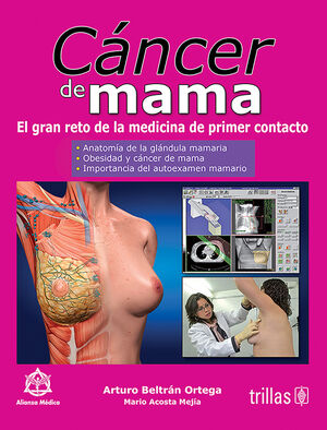 Cáncer de mama