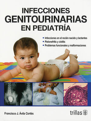 INFECCIONES GENITOURINARIAS EN PEDIATRIA