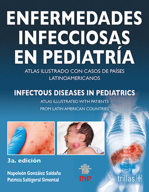 ENFERMEDADES INFECCIOSAS EN PEDIATRIA = INFECTOUS DISEASES IN PEDIATRICS