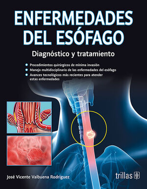 ENFERMEDADES DEL ESOFAGO