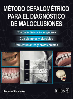 METODO CEFALOMETRICO PARA EL DIAGNOSTICO DE MALOCLUSIONES